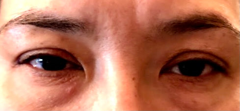 Micro-pigmentation/ Para-medical Tattoo (Cosmetic Tattoo)