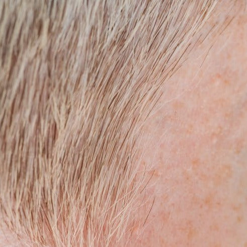 Micro-pigmentation/ Para-medical Tattoo (Cosmetic Tattoo)